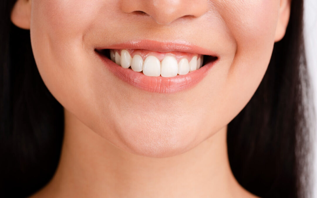 A Closer Look at Gum Recession