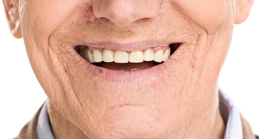 Benefits of modern dentures